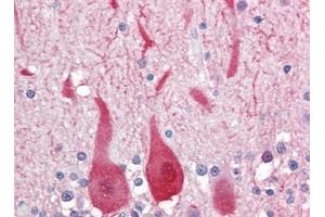 Human Brain, Cerebellum (formalin-fixed, paraffin-embedded) stained with ALDOCfollowed by biotinylated goat anti-rabbit IgG secondary antibody, alkaline phosphatase-streptavidin and chromogen.