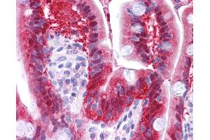 Anti-NME1 antibody IHC of human small intestine.
