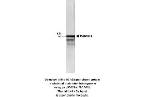 Image no. 1 for anti-Peripherin (PRPH) (full length) antibody (ABIN363318) (Peripherin anticorps  (full length))