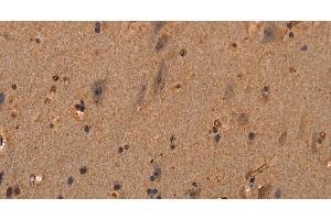 Immunohistochemistry of paraffin-embedded Human brain tissue using COL18A1 Polyclonal Antibody at dilution 1:40 (COL18A1 anticorps)