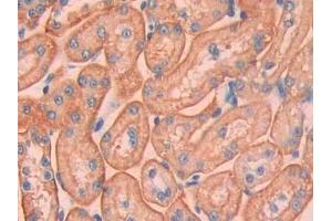 Detection of CA12 in Rat Kidney Tissue using Polyclonal Antibody to Carbonic Anhydrase XII (CA12)