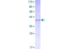 Image no. 1 for ADAM Metallopeptidase with Thrombospondin Type 1 Motif, 1 (ADAMTS1) (AA 858-967) protein (GST tag) (ABIN1305883)