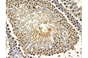ABIN7096863 and ABIN7100929 at 1/100 staining rat testis tissue by IHC-P. (RFX2 anticorps)