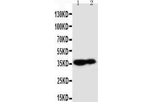 Anti-Kallikrein 9 antibody, Western blotting Lane 1: MCF-7 Cell Lysate Lane 2: A431 Cell Lysate (Kallikrein 9 anticorps  (C-Term))