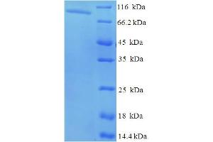 SDS-PAGE (SDS) image for N-Acetylated alpha-Linked Acidic Dipeptidase-Like 2 (NAALADL2) (AA 143-795), (Extracellular) protein (His-SUMO Tag) (ABIN5711381)