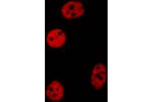 ABIN6272261 staining COLO205 by IF/ICC.