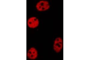 ABIN6272261 staining COLO205 by IF/ICC. (CEBPZ anticorps  (N-Term))