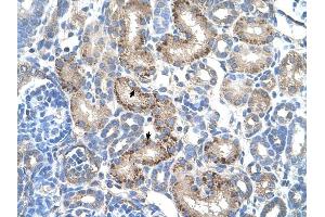 AADAT antibody was used for immunohistochemistry at a concentration of 4-8 ug/ml to stain EpitheliaI cells of renal tubule (arrows) in Human Kidney.