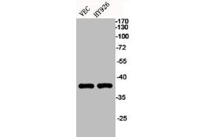 Western Blot analysis of VEC HY926 cells using EKLF/CKLF/UKLF Polyclonal Antibody (KLF1/5/7 anticorps  (C-Term))