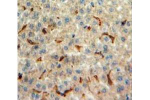 Used in DAB staining on fromalin fixed paraffin-embedded Liver tissue (Orexin A anticorps  (AA 33-124))