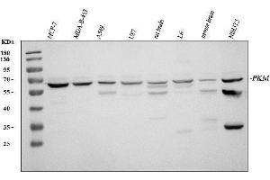 Western blot analysis of PKM2 using anti-PKM2 antibody (ABIN3043381). (PKM anticorps  (N-Term))