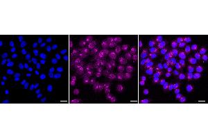 Immunocytochemical staining of HepG2 cells with DNPH1 antibody (ABIN7798082), 1:1,000). (Recombinant RCL anticorps)
