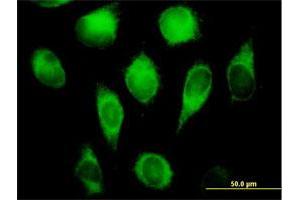 Immunofluorescence of purified MaxPab antibody to CYB5R3 on HeLa cell. (CYB5R3 anticorps  (AA 1-301))