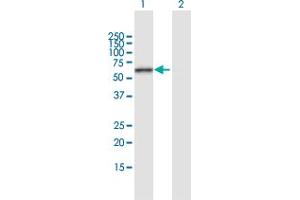 Western Blot analysis of ERO1L expression in transfected 293T cell line by ERO1L MaxPab polyclonal antibody. (ERO1L anticorps  (AA 1-468))