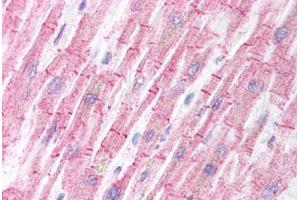 Human Heart (formalin-fixed, paraffin-embedded) stained with BCL2L11 antibody ABIN213909 at 5 ug/ml followed by biotinylated goat anti-rabbit IgG secondary antibody ABIN481713, alkaline phosphatase-streptavidin and chromogen. (BIM anticorps  (Internal Region))