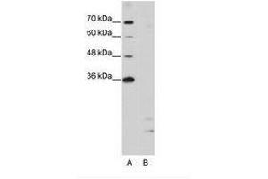 Image no. 1 for anti-Peptidylprolyl Isomerase E (Cyclophilin E) (PPIE) (AA 191-240) antibody (ABIN203035)