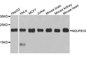 Western blot analysis of extracts of various cell lines, using NDUFB10 antibody. (NDUFB10 anticorps)