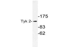 Western blot (WB) analysis of Tyk 2 antibody in extracts from 293cells. (TYK2 anticorps)