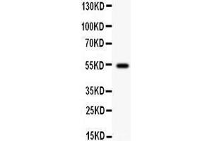 Anti- Cyclin A1 Picoband antibody, Western blotting All lanes: Anti Cyclin A1  at 0. (Cyclin A1 anticorps  (AA 64-263))
