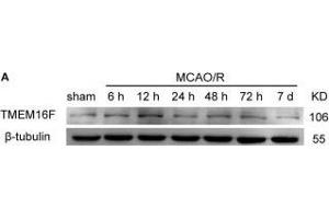 TMEM16F protein level increases after ischemic insult.