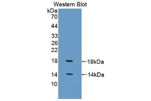 Detection of Recombinant FABP4, Chicken using Polyclonal Antibody to Fatty Acid Binding Protein 4 (FABP4) (FABP4 anticorps  (AA 1-125))