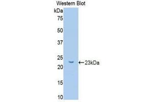 Western Blotting (WB) image for anti-Glucokinase (Hexokinase 4) Regulator (GCKR) (AA 90-286) antibody (ABIN1078068) (GCKR anticorps  (AA 90-286))