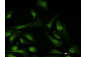 Immunofluorescence of purified MaxPab antibody to PPP6C on HeLa cell.