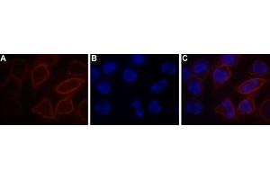 Expression of STIM1 in RBL cells - Cell surface detection of STIM1 in live RBL cells. (STIM1 anticorps  (Extracellular, N-Term) (Atto 550))