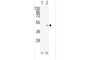 Western blot analysis of ADH1C (arrow) using rabbit polyclonal ADH1C Antibody (Center) (ABIN651725 and ABIN2840376).
