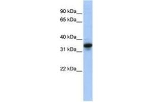 Image no. 1 for anti-Mucin 3B, Cell Surface Associated (MUC3B) (AA 36-85) antibody (ABIN6744267) (MUC3B anticorps  (AA 36-85))