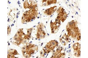 Immunohistochemistry analysis of paraffin-embedded human stomach using IL22RA1 Polyclonal Antibody at dilution of 1:200. (IL22 Receptor alpha 1 anticorps)