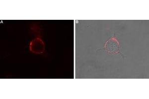 Expression of NK1 receptor in rat PC12 cells - Cell surface detection of NK1 Receptor in intact living rat pheochromocytoma (PC12) cells.