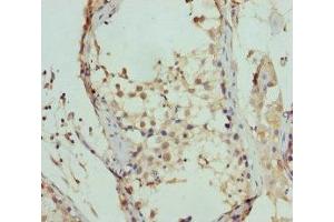 Immunohistochemistry of paraffin-embedded human testis tissue using ABIN7152449 at dilution of 1:100 (FBXO7 anticorps  (AA 353-522))