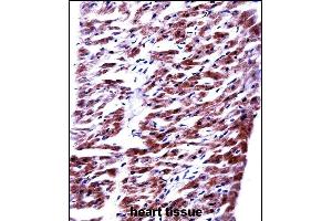 RM33 Antibody (C-term) ((ABIN657799 and ABIN2846772))immunohistochemistry analysis in formalin fixed and paraffin embedded human heart tissue followed by peroxidase conjugation of the secondary antibody and DAB staining. (MRPL33 anticorps  (C-Term))