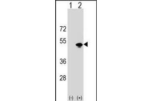 Western blot analysis of KRR1 (arrow) using rabbit polyclonal KRR1 Antibody (N-term) (ABIN1538757 and ABIN2848753).