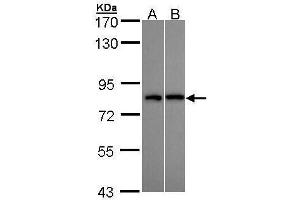 WB Image Sample (30 ug of whole cell lysate) A: H1299 B: Hep G2 , 7.