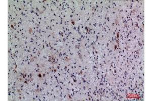 Immunohistochemistry (IHC) analysis of paraffin-embedded Human Brain, antibody was diluted at 1:100. (FGF5 anticorps  (C-Term))