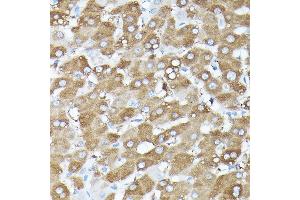 Immunohistochemistry of paraffin-embedded human liver using MLST8 Rabbit pAb (ABIN6131371, ABIN6143894, ABIN6143895 and ABIN6217660) at dilution of 1:100 (40x lens).
