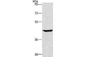 Western blot analysis of HT-29 cell, using GCK Polyclonal Antibody at dilution of 1:450 (GCK anticorps)