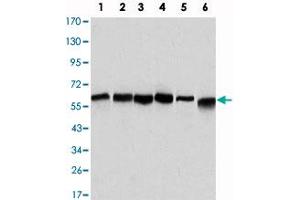 Western blot analysis using BECN1 monoclonal antibody, clone 2A4  against HeLa (1), A-431 (2), MCF-7 (3), Raji (4), Jurkat (5) and SK-BR-3 (6) cell lysate.