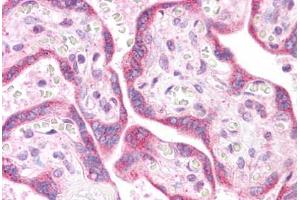 Human Placenta: Formalin-Fixed, Paraffin-Embedded (FFPE)