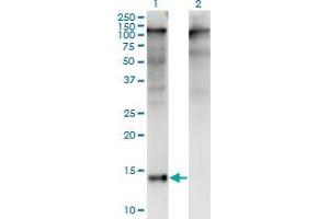 Western Blot analysis of ZBTB16 expression in transfected 293T cell line by ZBTB16 monoclonal antibody (M01), clone 3A7. (ZBTB16 anticorps  (AA 381-480))