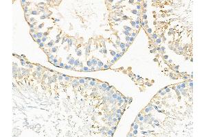 ABIN6257384 and ABIN6275302 at 1/100 staining Rat testis tissue by IHC-P. (Neurocan anticorps  (Internal Region))