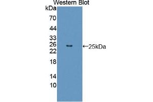 Detection of Recombinant FGF12, Human using Polyclonal Antibody to Fibroblast Growth Factor 12 (FGF12) (FGF12 anticorps  (AA 1-181))
