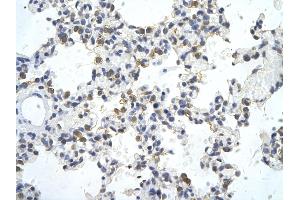 Rabbit Anti-ZNF444 antibody        Paraffin Embedded Tissue:  Human Lung cell   Cellular Data:  Epithelial cells of renal tubule  Antibody Concentration:   4. (ZNF444 anticorps  (C-Term))