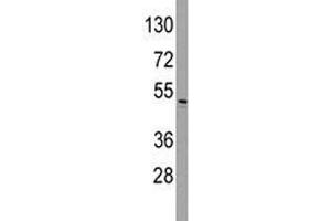 Western blot analysis of ILK antibody and HeLa lysate. (ILK anticorps  (AA 225-253))