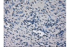 Immunohistochemical staining of paraffin-embedded liver tissue using anti-CYP2E1 mouse monoclonal antibody. (CYP2E1 anticorps)