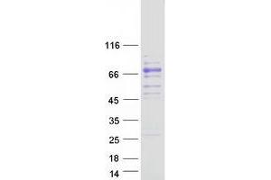 Validation with Western Blot