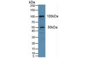 Western blot analysis of Human HeLa cells. (PLA2G4A anticorps  (AA 1-178))