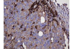 Image no. 5 for anti-Fibronectin Type III Domain Containing 4 (FNDC4) antibody (ABIN1498289)